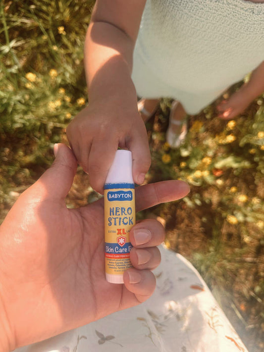 De Hero Stick, natuurlijke verzorging bij kleine ongelukjes